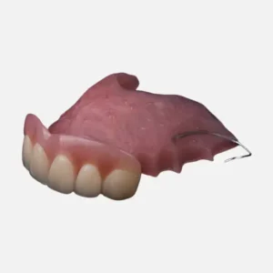 Partial Acrylic Denture Toronto